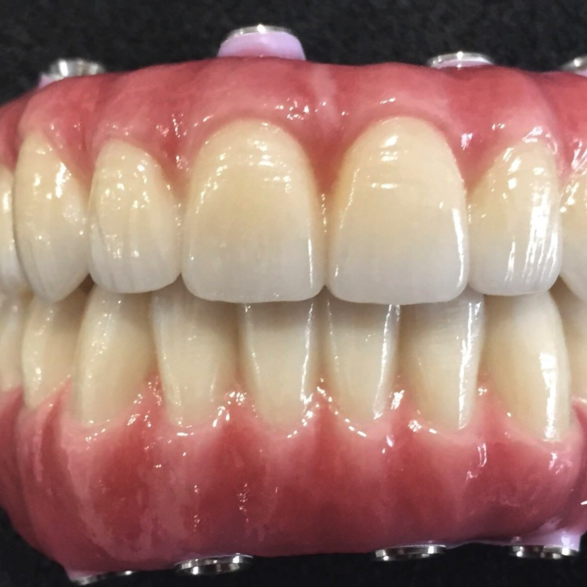 All-On 4 Hybrid photo