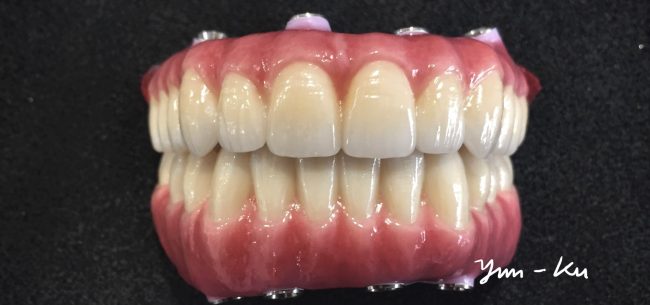 All-On 4 Hybrid photo