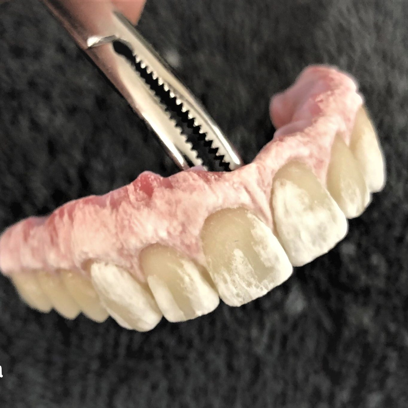 Crown & Bridge photo