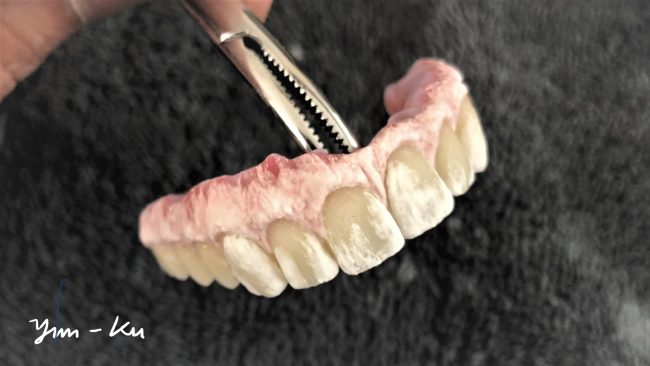 Crown & Bridge photo