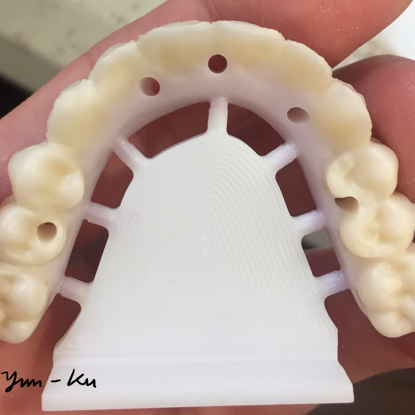 All-On-4 process image