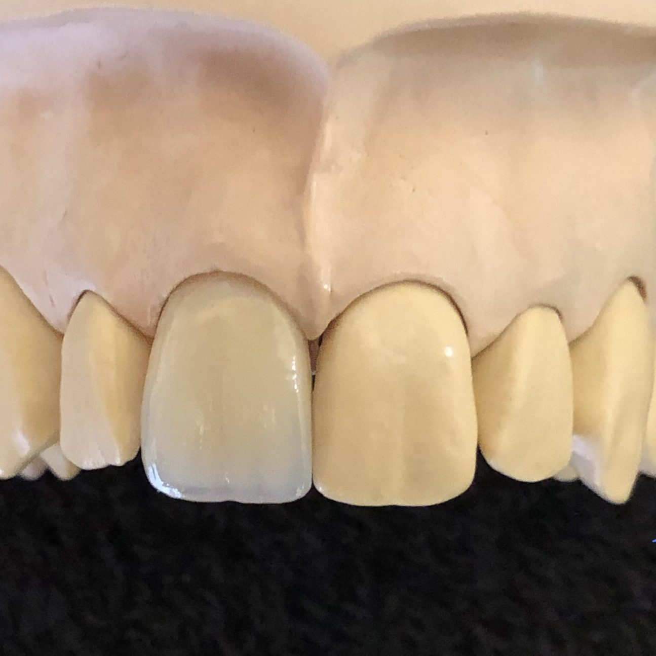 Crown & Bridge photo