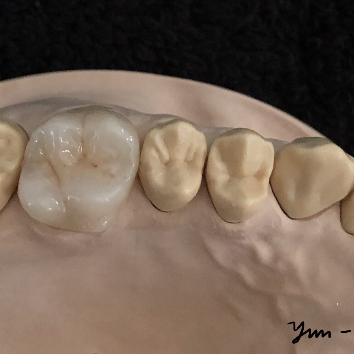 Crown & Bridge photo