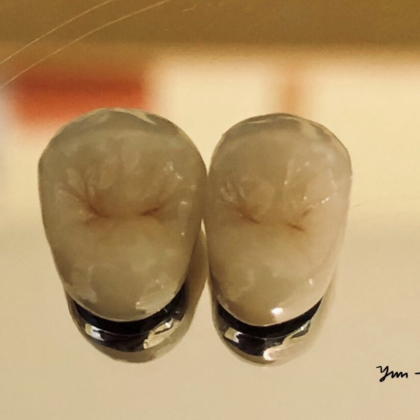 Crown & Bridge photo