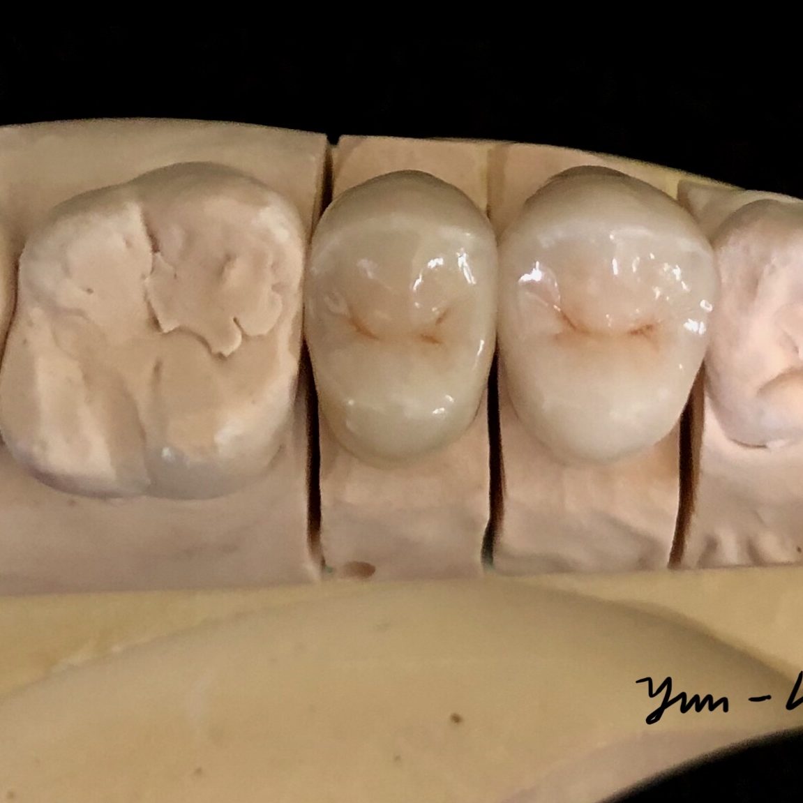 Crown & Bridge photo