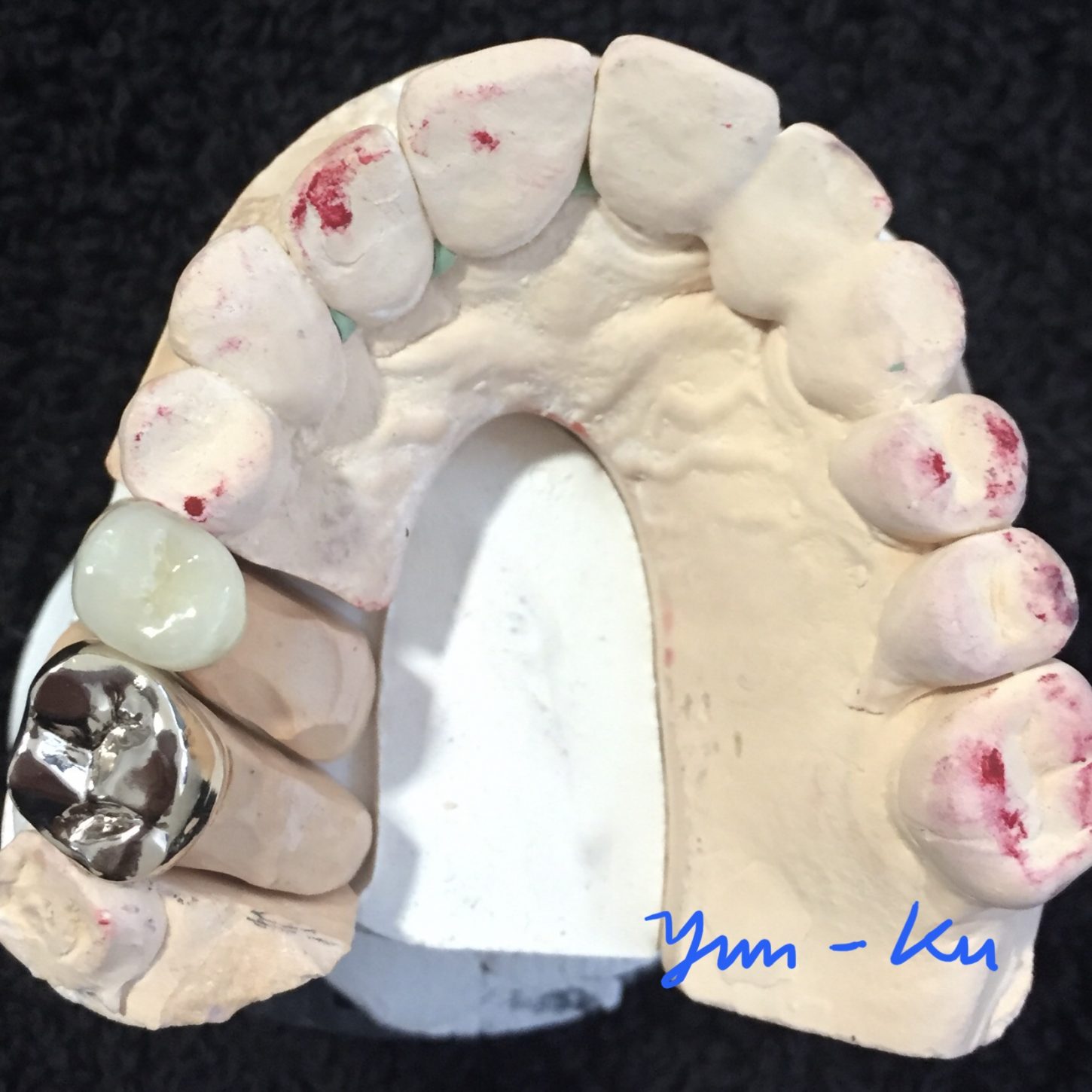 Crown & Bridge photo