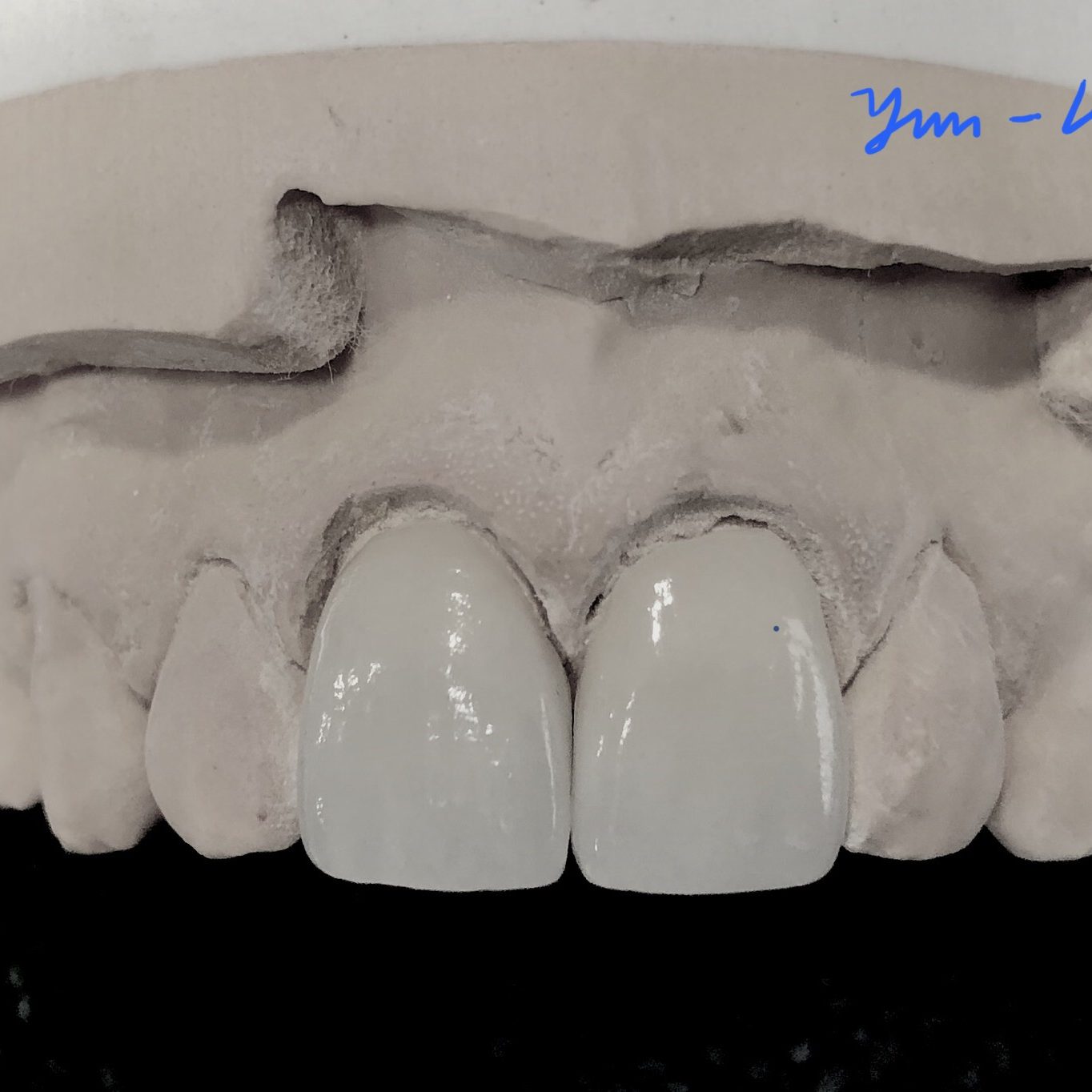 Crown & Bridge photo