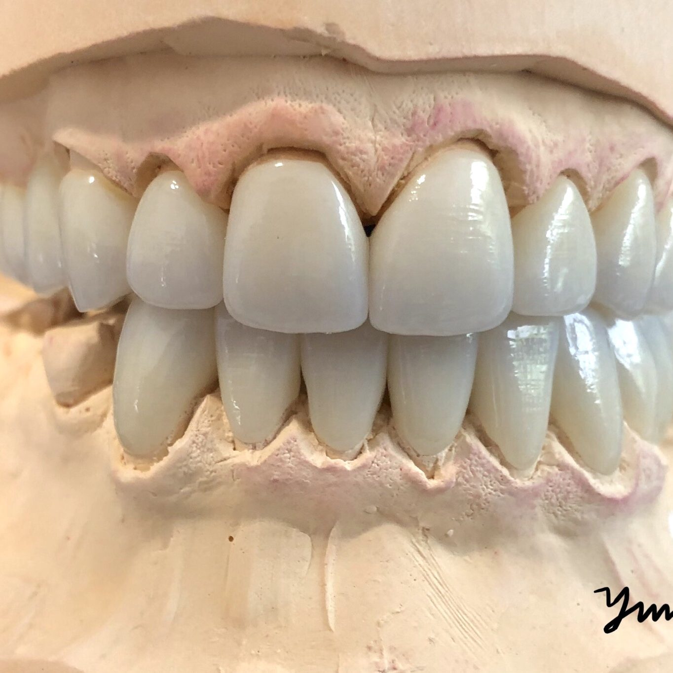 Crown & Bridge photo