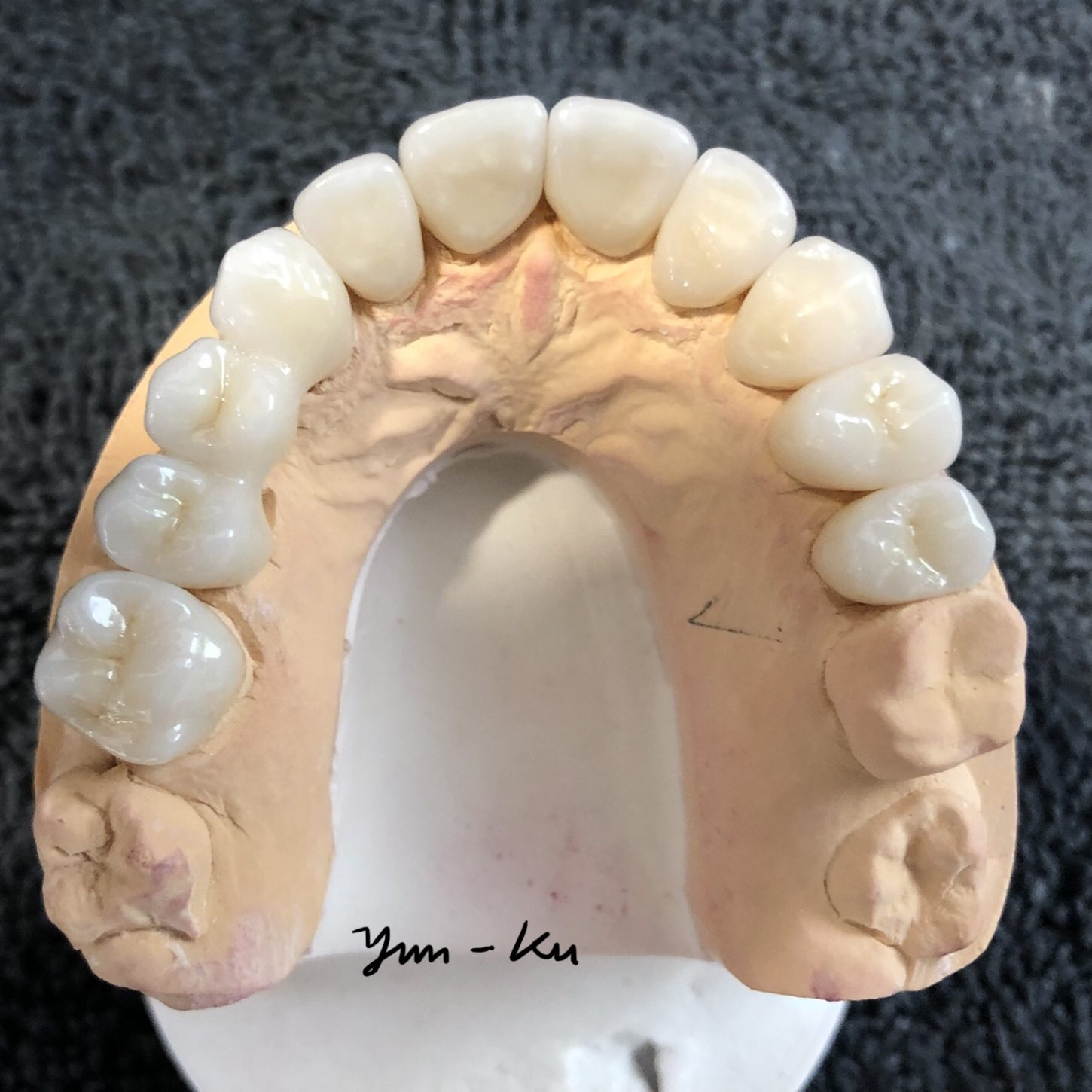 Crown & Bridge photo