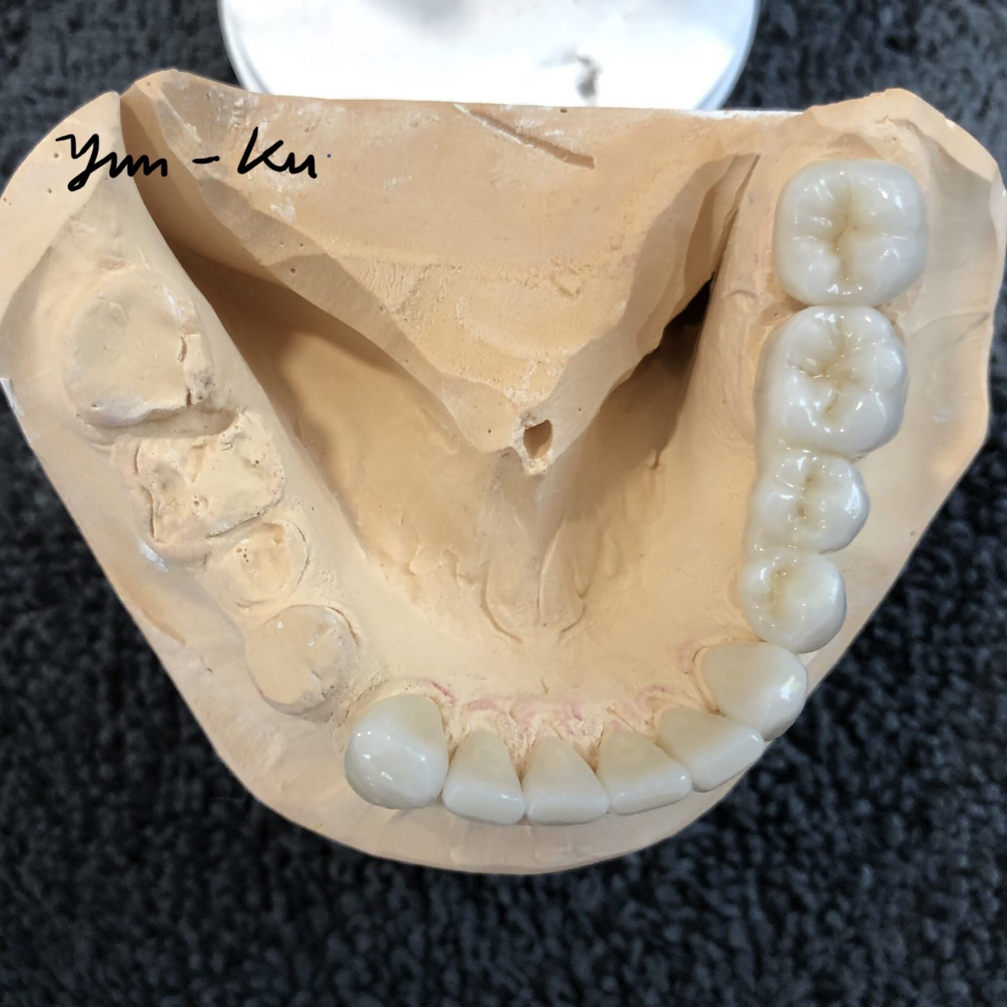 Crown & Bridge photo