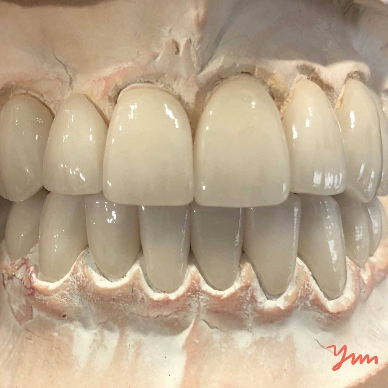 Crown & Bridge photo