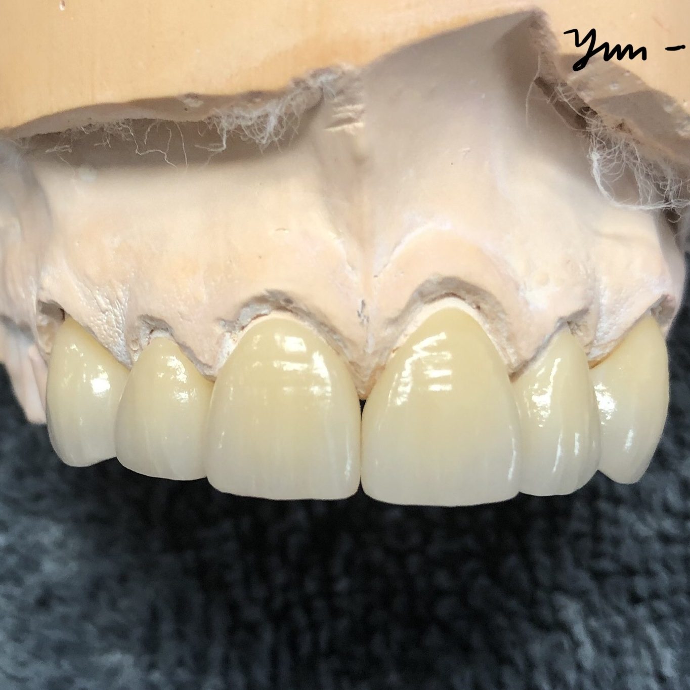 Crown & Bridge photo