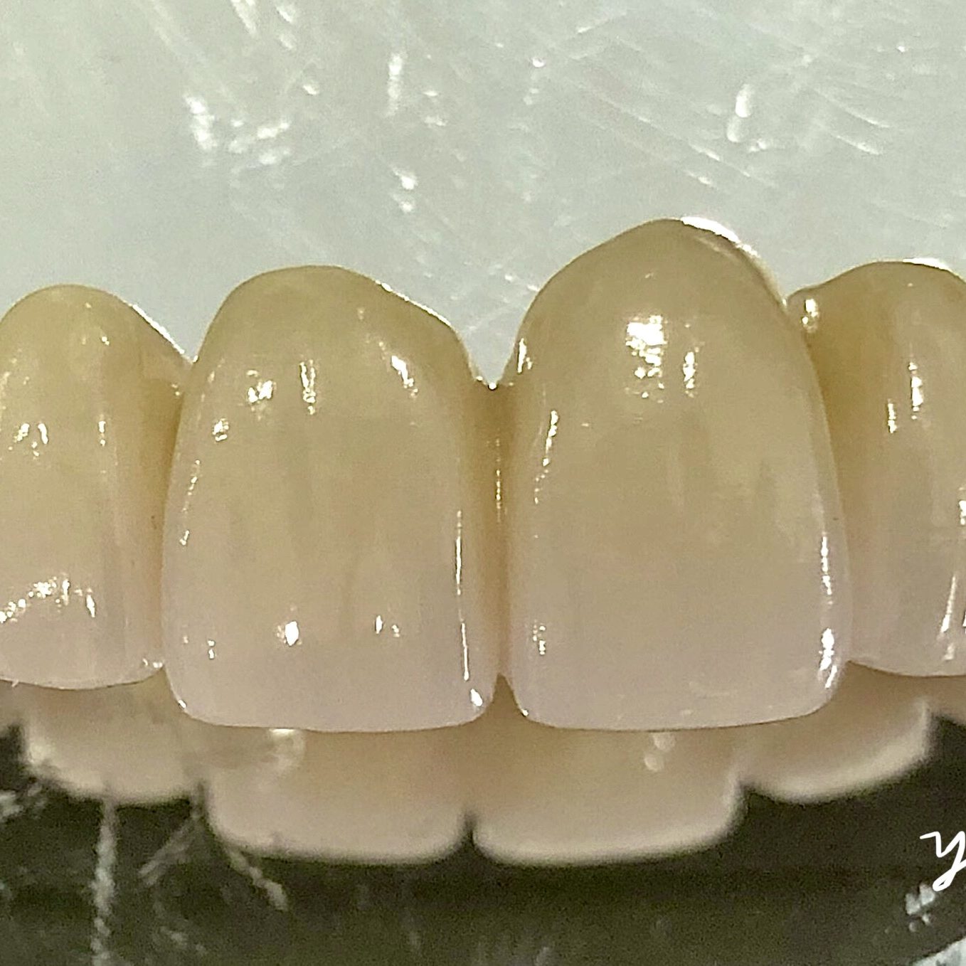 Crown & Bridge photo