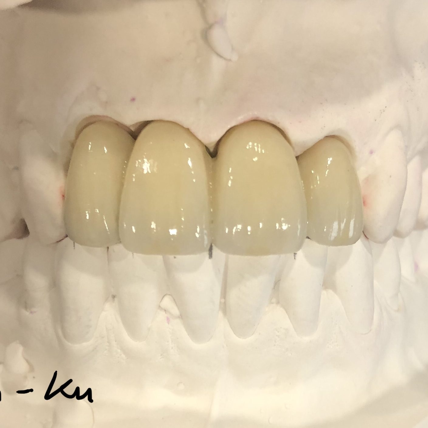 Crown & Bridge photo