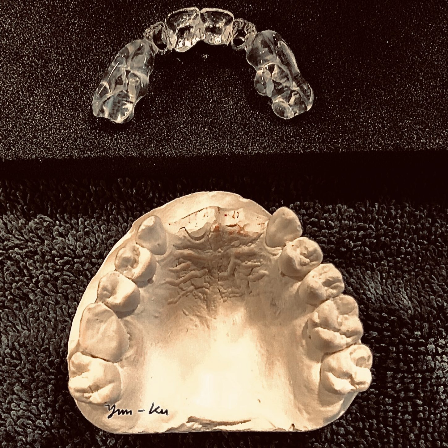 Dental implant photo