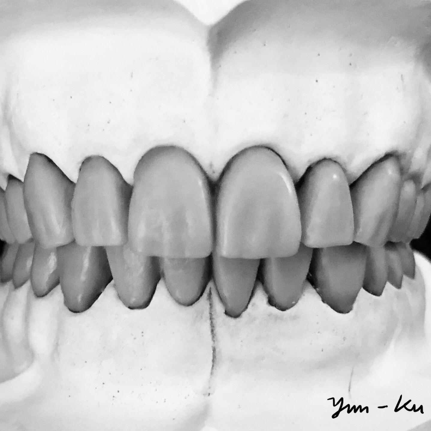 Diagnostic waxup 1-1